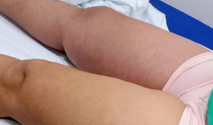 Vaquinha solidário Valderlandia